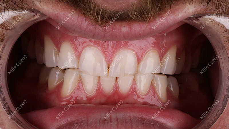 Old Dental Work